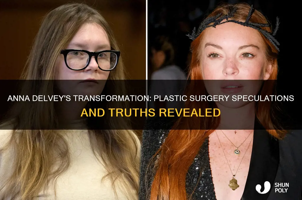has anna delvey had plastic surgery