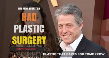 Anna Eberstein Plastic Surgery: Fact-Checking Rumors and Speculations