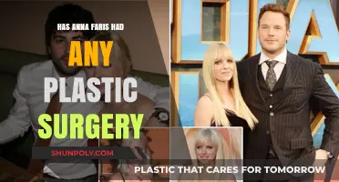 Anna Faris Plastic Surgery: Fact-Checking the Rumors and Speculations