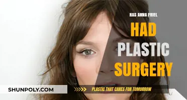 Anna Friel Plastic Surgery: Fact-Checking the Rumors and Speculations