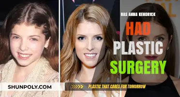 Anna Kendrick's Transformation: Plastic Surgery Rumors Explored and Debunked