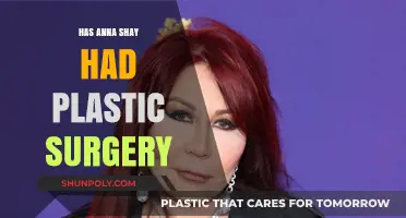 Has Anna Shay Undergone Plastic Surgery? Unveiling the Truth