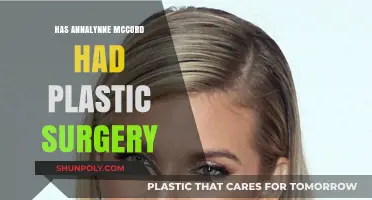 Annalynne McCord's Transformation: Plastic Surgery Rumors Explored