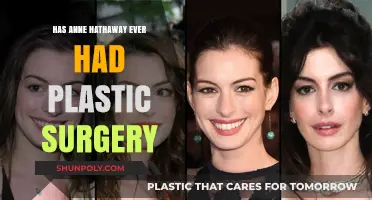 Anne Hathaway's Transformation: Plastic Surgery Rumors Explored