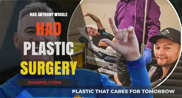 Anthony Wiggle Plastic Surgery Rumors: Fact or Fiction?