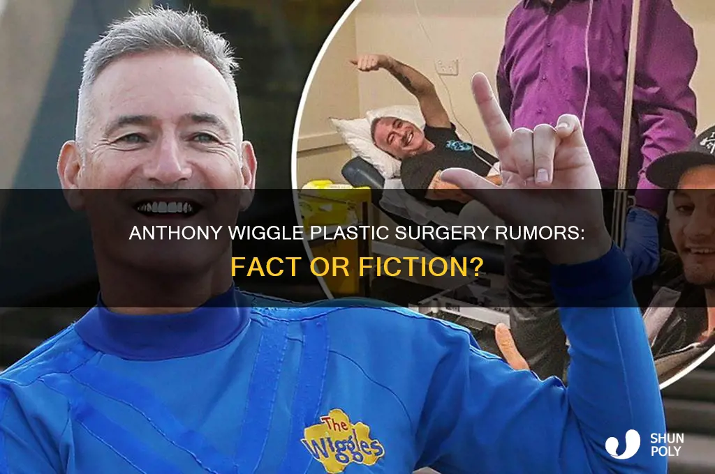 has anthony wiggle had plastic surgery