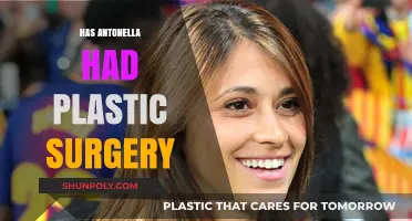 Has Antonella Had Plastic Surgery? Uncovering the Truth Behind Her Look