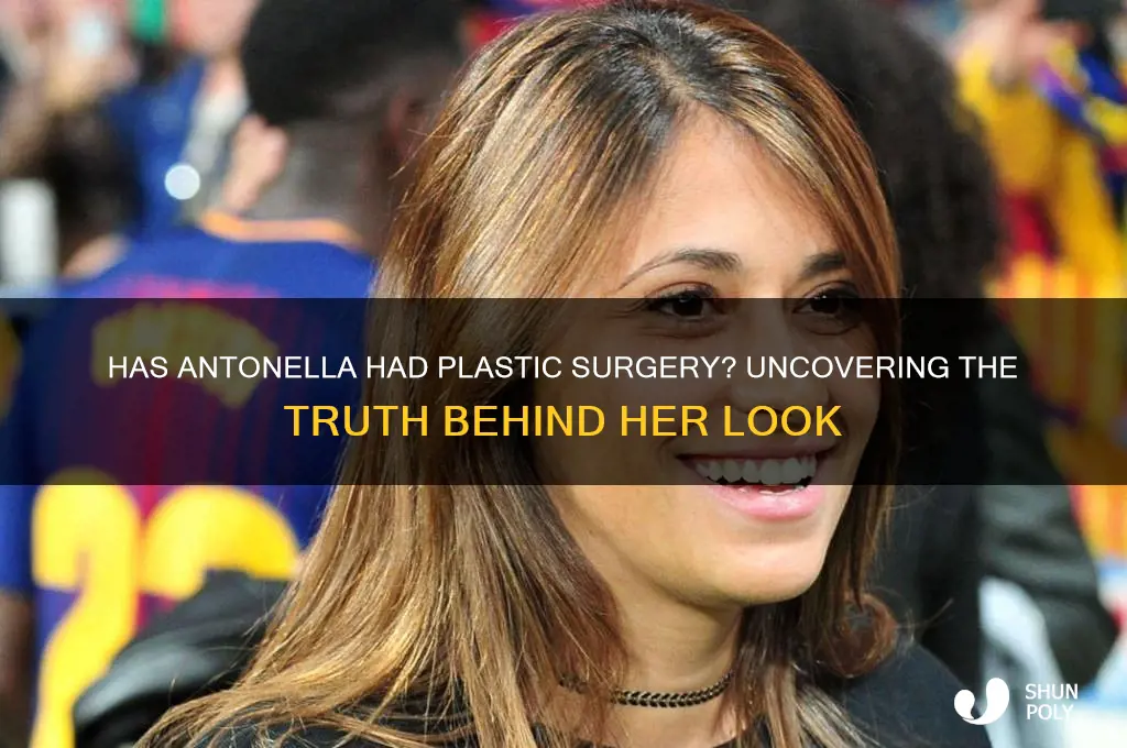 has antonella had plastic surgery