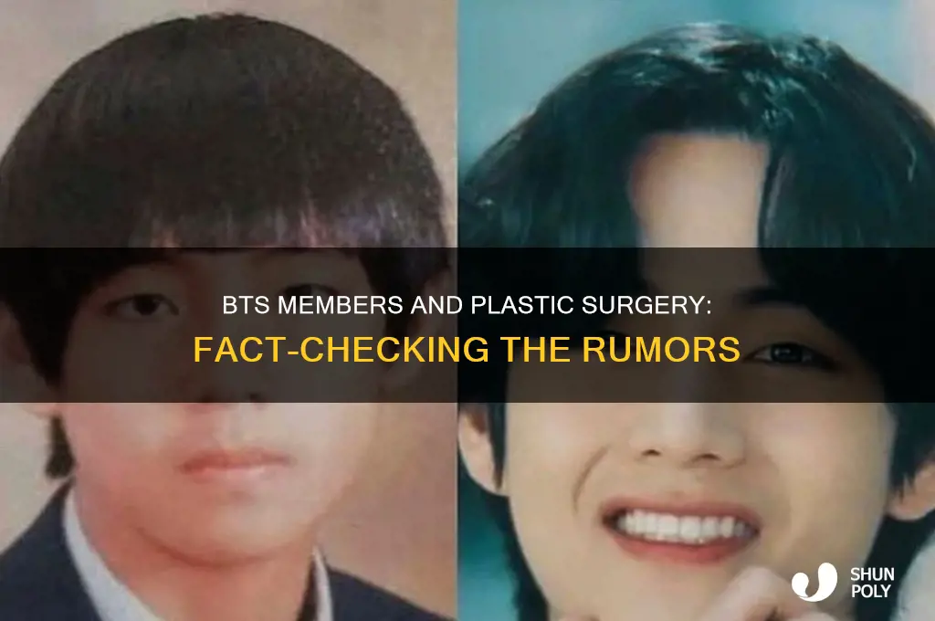 has any bts member had plastic surgery