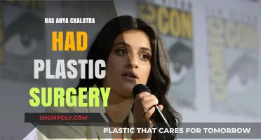 Anya Chalotra Plastic Surgery: Fact-Checking the Rumors and Speculations