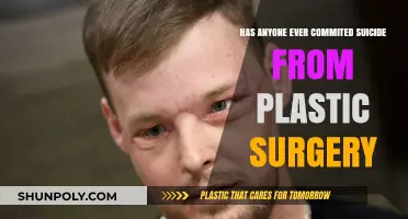 Plastic Surgery and Suicide: Uncovering the Dark Side of Beauty