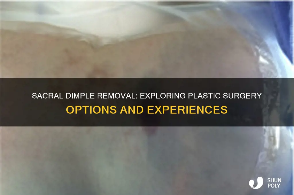 has anyone ever had plastic surgery to remove sacral dimples