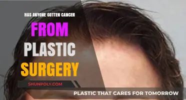 Plastic Surgery and Cancer Risk: Separating Fact from Fiction