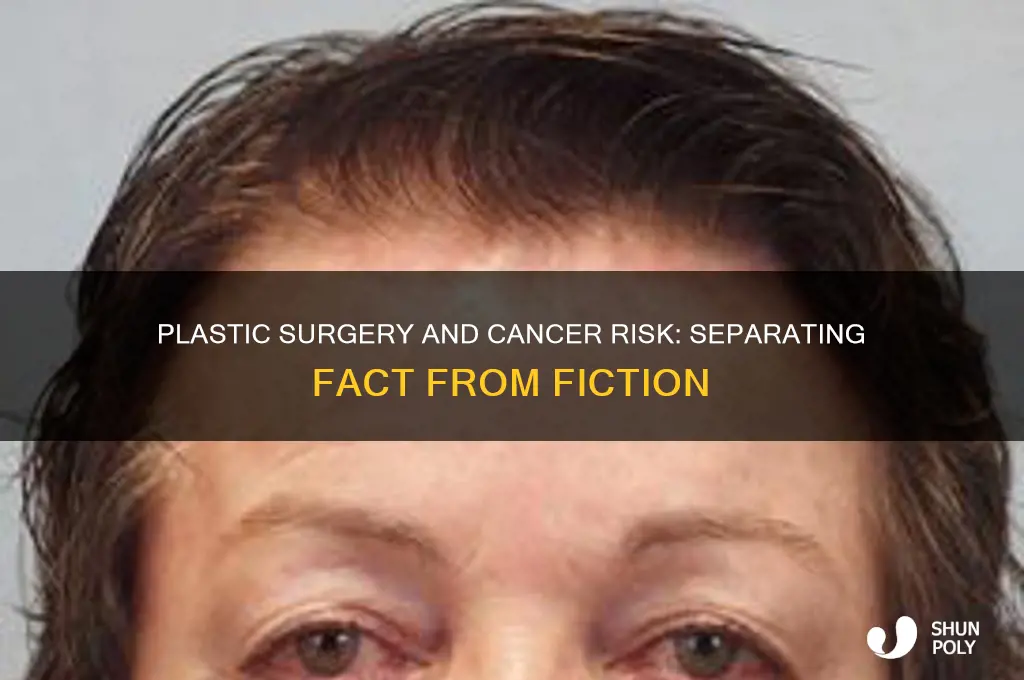 has anyone gotten cancer from plastic surgery