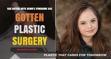 Plastic Surgery and Down Syndrome: Exploring Personal Choices and Experiences