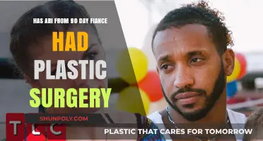 Ari's Transformation: Plastic Surgery Rumors on 90 Day Fiancé Explored