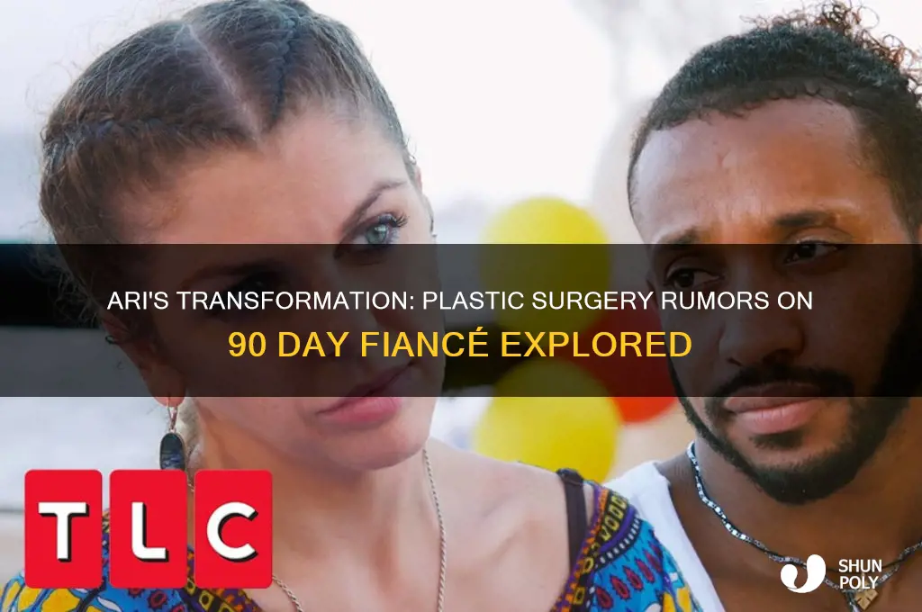 has ari from 90 day fiance had plastic surgery