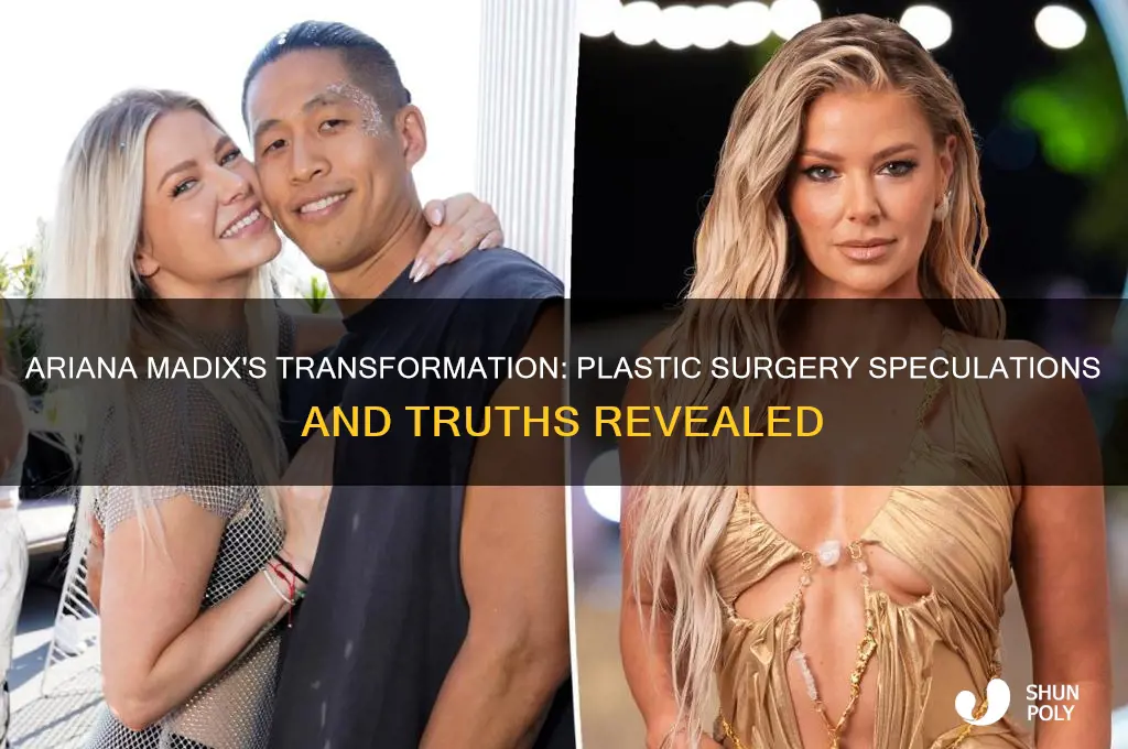 has ariana madix had plastic surgery