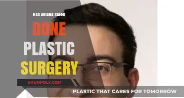Ariana Saeed's Transformation: Plastic Surgery Speculations and Truths