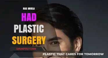Ariela's Transformation: Unveiling the Truth About Plastic Surgery Rumors