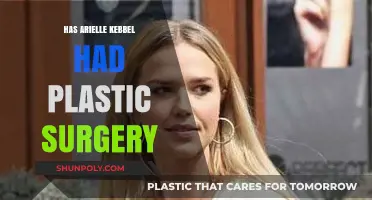 Arielle Kebbel's Transformation: Plastic Surgery Rumors Explored