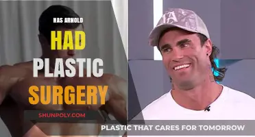 Arnold Schwarzenegger's Transformation: Plastic Surgery Speculations and Facts