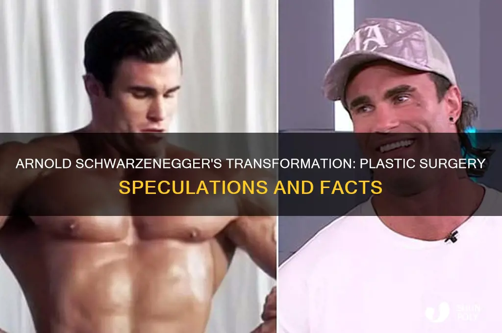 has arnold had plastic surgery