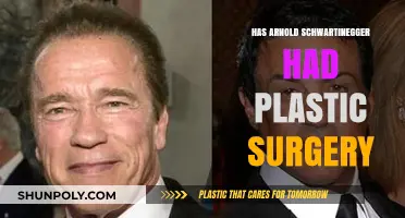 Arnold Schwarzenegger's Transformation: Plastic Surgery Rumors Explored