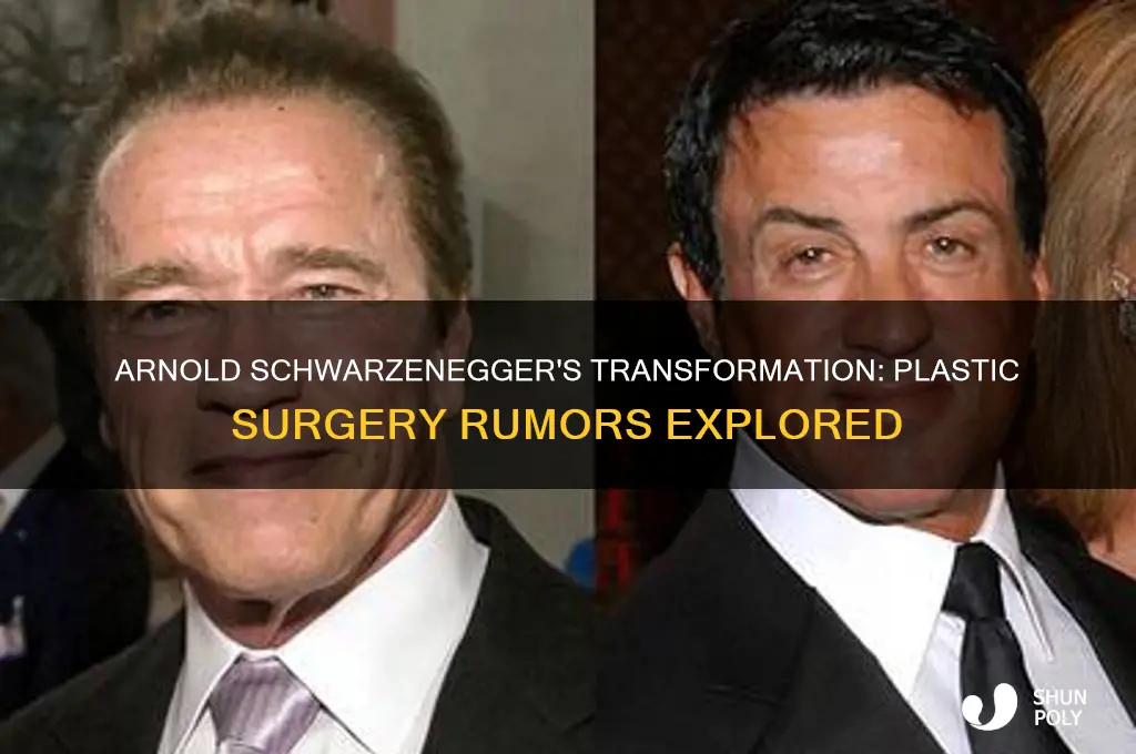 has arnold schwartinegger had plastic surgery