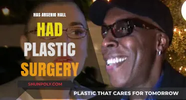 Arsenio Hall Plastic Surgery: Fact or Fiction? Unveiling the Truth