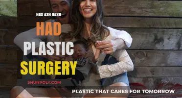 Ash Kash Plastic Surgery: Fact-Checking the Rumors and Speculations
