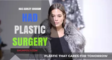 Ashley Graham Plastic Surgery: Fact-Checking the Rumors and Speculations