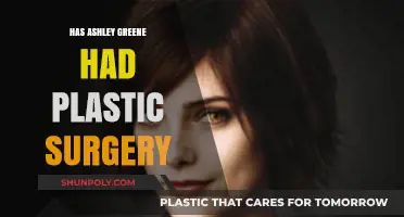 Ashley Greene's Transformation: Plastic Surgery Rumors Explored and Debunked