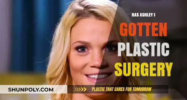 Ashley I. Plastic Surgery: Fact-Checking the Rumors and Speculations