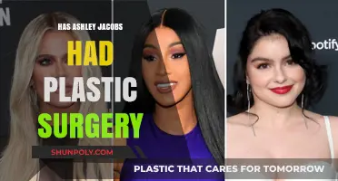Ashley Jacobs Plastic Surgery: Fact-Checking Rumors and Speculations