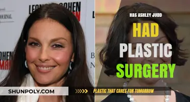 Ashley Judd's Appearance: Plastic Surgery Speculations and Truths Revealed