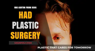 Ashton Irwin's Transformation: Plastic Surgery Rumors Explored