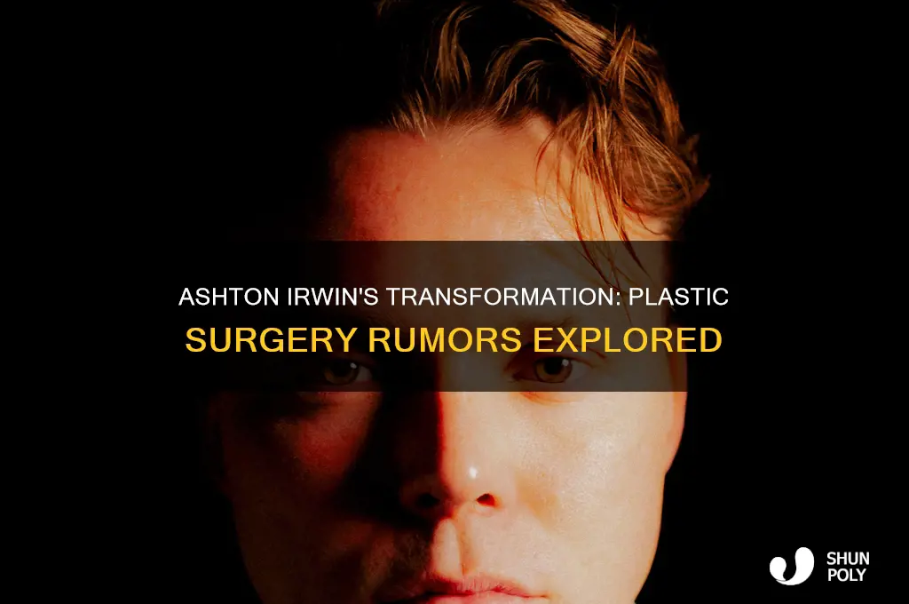 has ashton from 5sos had plastic surgery