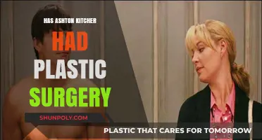 Has Ashton Kutcher Had Plastic Surgery? Unveiling the Truth