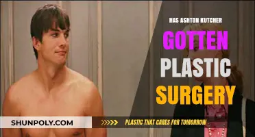 Ashton Kutcher's Changing Looks: Plastic Surgery Rumors Explored