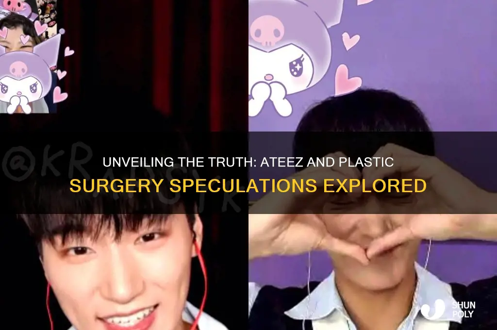 has ateez had plastic surgery