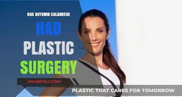 Autumn Calabrese Plastic Surgery: Fact-Checking the Fitness Guru's Transformation