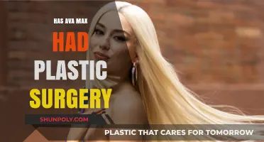 Ava Max's Transformation: Plastic Surgery Rumors and Speculations Explored