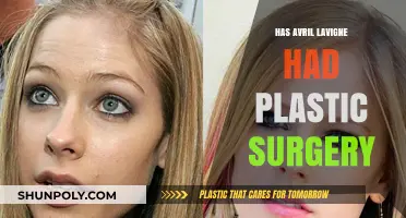 Avril Lavigne's Transformation: Plastic Surgery Rumors Explored and Debunked