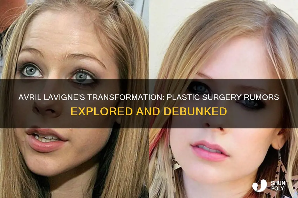 has avril lavigne had plastic surgery