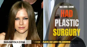 Plastic Surgery Speculation: Avril Lavigne's Transformation