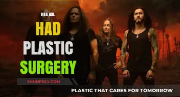 Has Axl Rose Undergone Plastic Surgery? Examining the Evidence