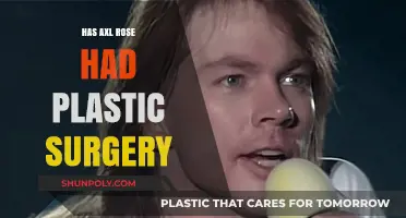 Axl Rose's Transformation: Plastic Surgery Rumors and Reality