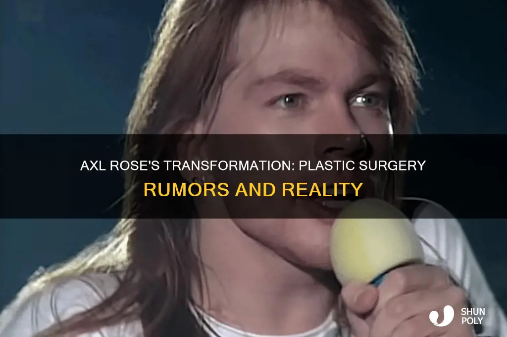 has axl rose had plastic surgery
