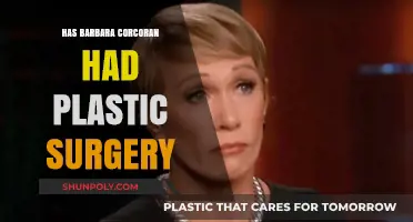 Barbara Corcoran's Transformation: Plastic Surgery Rumors Explored